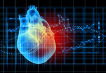 Cardiac test monitoring